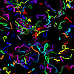 Tracking of motile cells
