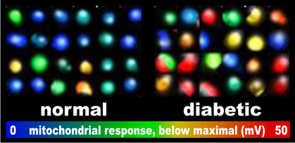 Diabetic and non-diabetic beta-cells