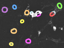 Quantitative analysis of senescence associated beta-galacosidase (sa-bgal) staining