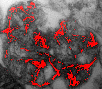 Analysis of transmission electron micrographs for phosphate precipitates