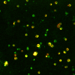 Human beta-cell with TMRM and FLIPR