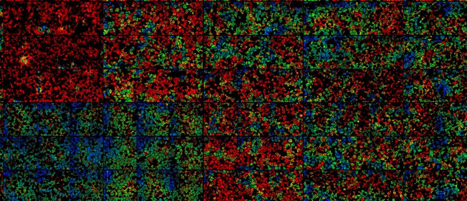 Image Analyst MKII - Reactive Oxygen Species Analysis