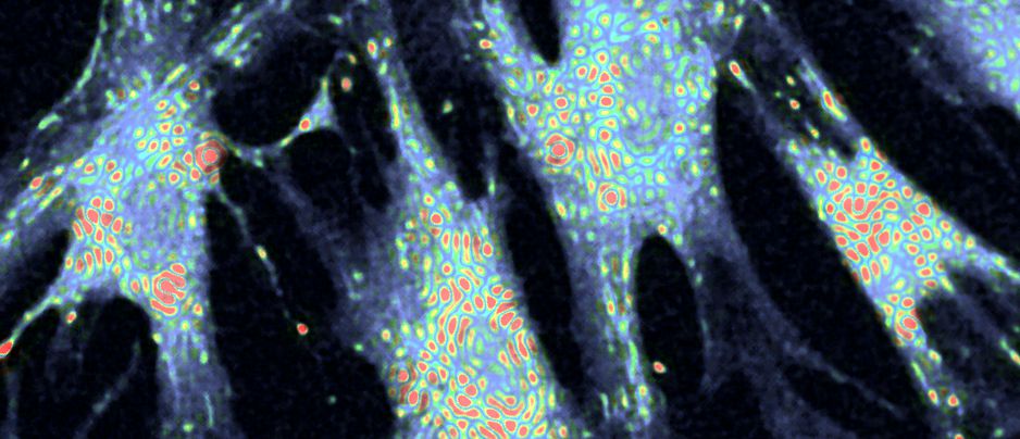 Image Analyst MKII - Mitochondrial autofluorescence