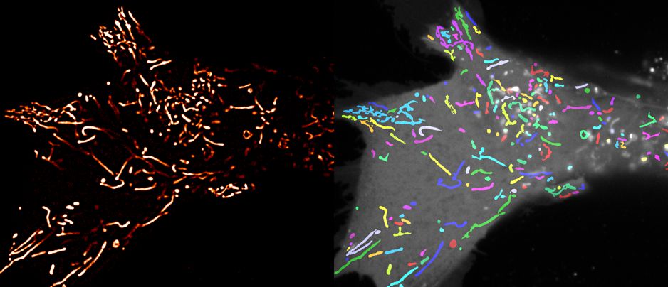 Image Analyst MKII - Mitochondrial Volume Fractionator